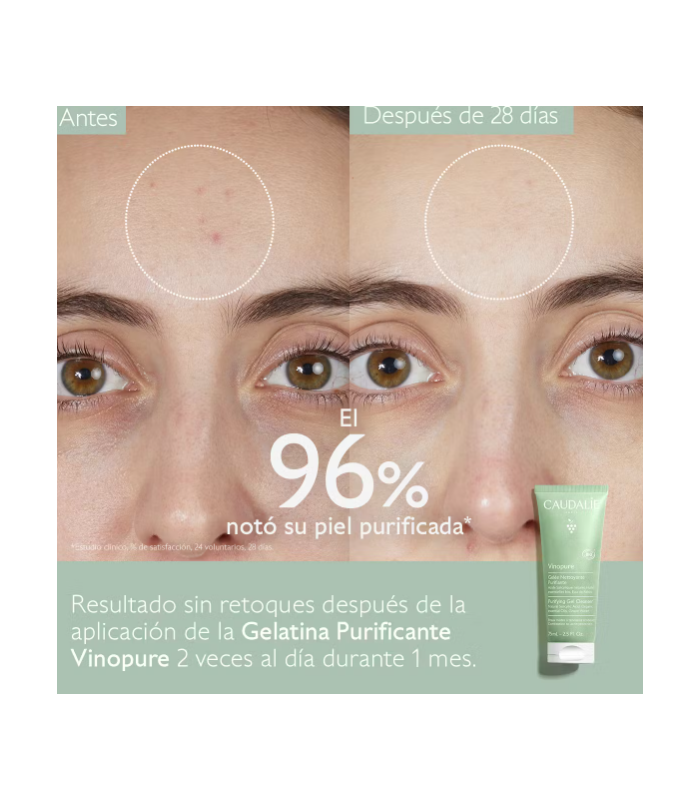 Caudalie Vinopure Gelatina Limpiadora Purificante, 75ml