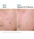 SkinCeuticals Advanced RGN-6 Crema Rejuvenecedora & Reparadora, 50ml + Regalo P-tiox Sérum 15ml