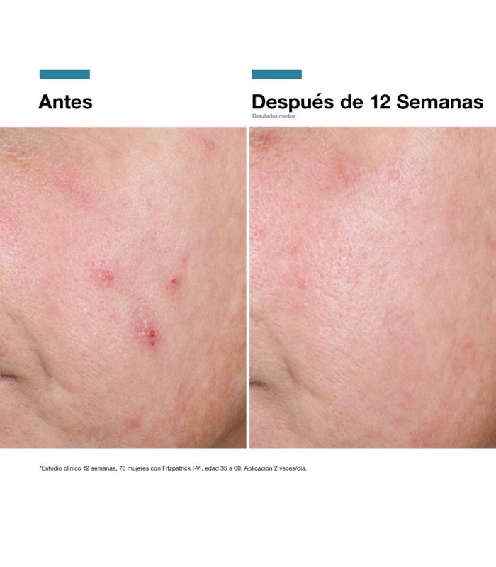 SkinCeuticals Advanced RGN-6 Crema Rejuvenecedora & Reparadora, 50ml + Regalo P-tiox Sérum 15ml
